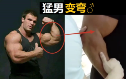 健美肌肉不对称